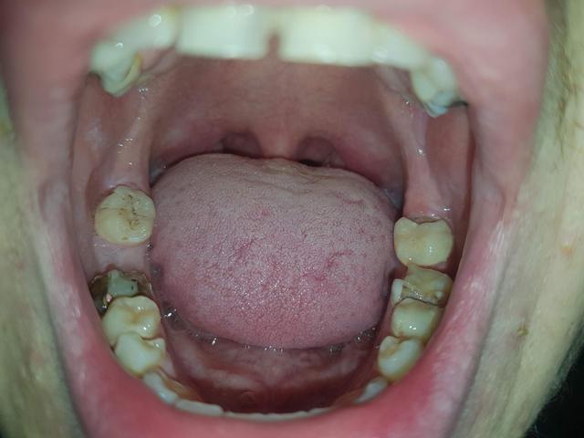 Die Perspektive der Zahnärzte auf schlechte Zähne: Tipps und Ratschläge