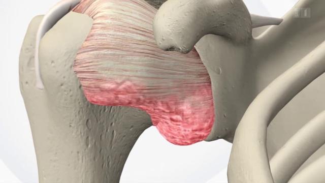 Die spirituelle Bedeutung von Schulterbeschwerden wie der Frozen Shoulder