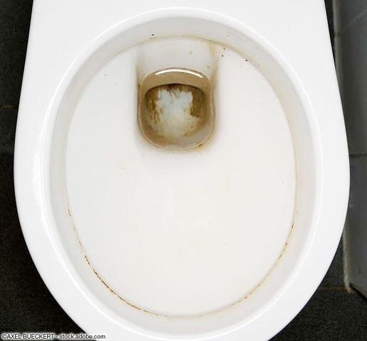 Urinstein bekämpfen: Praktische Tipps für eine saubere Toilette