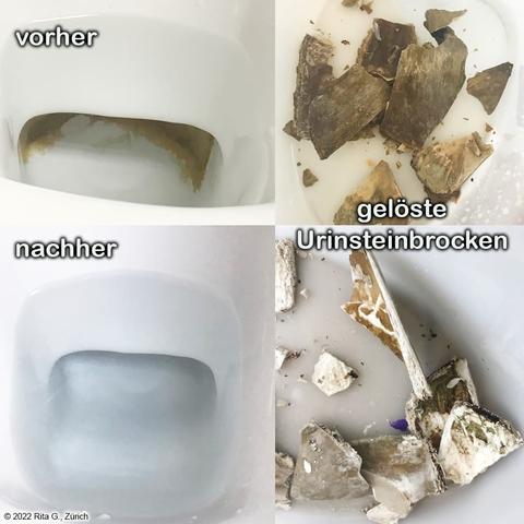 Urinstein entfernen: Die besten Methoden im Überblick