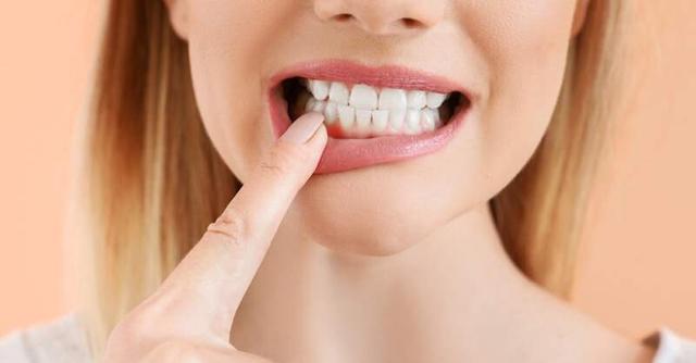 Zahngesundheit durch umfassende Zahnhygiene: Vorbeugung und Behandlung von Zahnfleischentzündungen