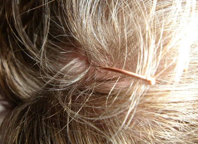 Soforthilfe bei juckender Kopfhaut: Was tun?