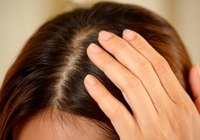 Natürliche Behandlungsmethoden für juckende Kopfhaut