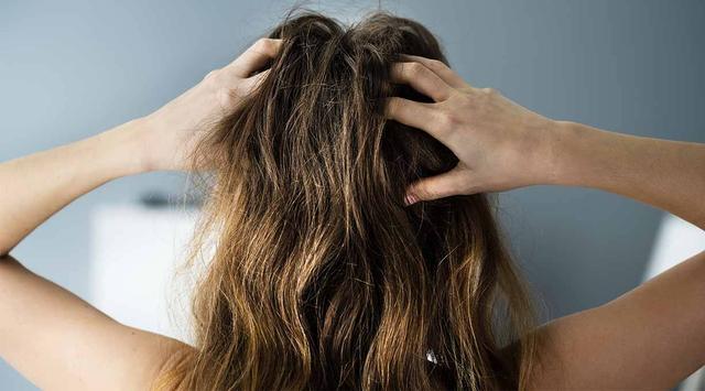 Tipps und Tricks gegen juckende Kopfhaut