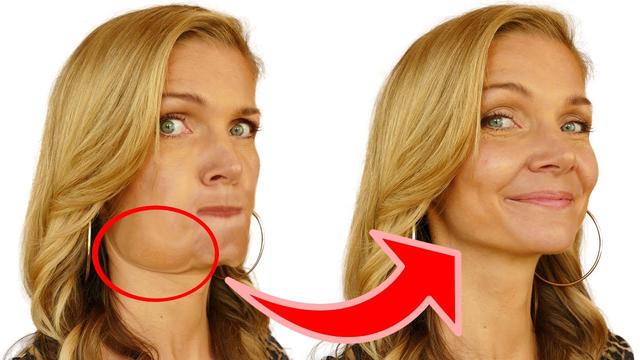 Hängebäckchen adé: Neue Behandlungsmöglichkeiten für ein jugendliches Aussehen Hängebäckchen adé: Neue Behandlungsmöglichkeiten für ein jugendliches Aussehen