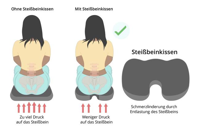 Steißbeinverletzung: Schmerzlindernde Maßnahmen nach einem Sturz Steißbeinverletzung: Schmerzlindernde Maßnahmen nach einem Sturz
