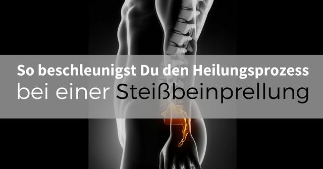 Praktische Tipps bei Schmerzen nach einem Sturz auf das Steißbein Praktische Tipps bei Schmerzen nach einem Sturz auf das Steißbein