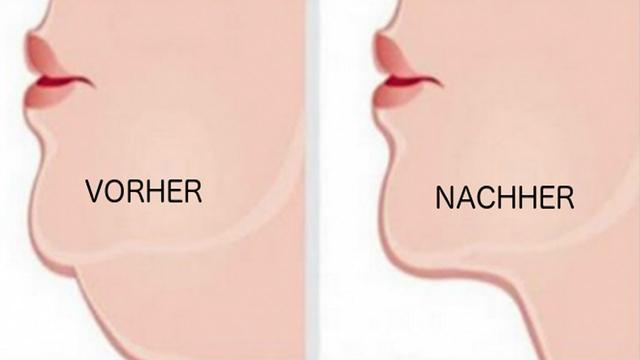 Wie man ein Doppelkinn kaschieren oder trainieren kann