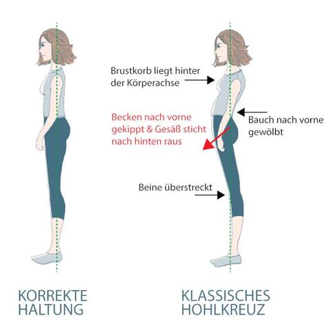 Haltungsschäden vorbeugen: Wie Sie dem Hohlkreuz effektiv entgegenwirken können Haltungsschäden vorbeugen: Wie Sie dem Hohlkreuz effektiv entgegenwirken können