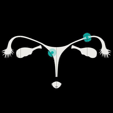 Eileiterschwangerschaft: Ab welchem Zeitpunkt treten Schmerzen auf? Eileiterschwangerschaft: Ab welchem Zeitpunkt treten Schmerzen auf?