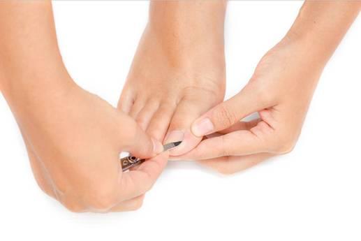 Selbsthilfe bei eingewachsenen Zehennägeln: Praktische Tipps und Tricks