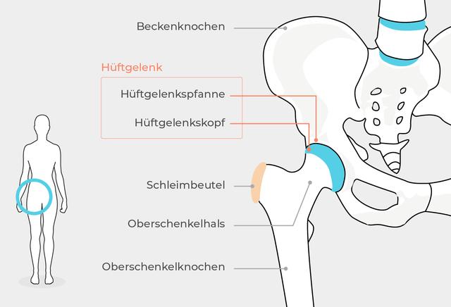 Ursachen und Behandlung von einseitigen Hüftschmerzen Ursachen und Behandlung von einseitigen Hüftschmerzen