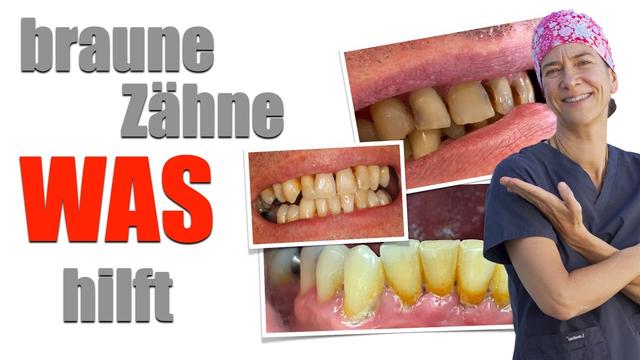 Selbstbehandlung von braunen Flecken auf den Zähnen: Was funktioniert wirklich?