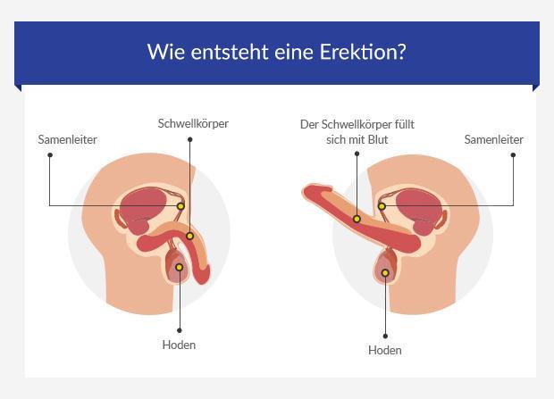 Erektionsprobleme: Ursachen, Behandlung und wie man Hilfe bekommt