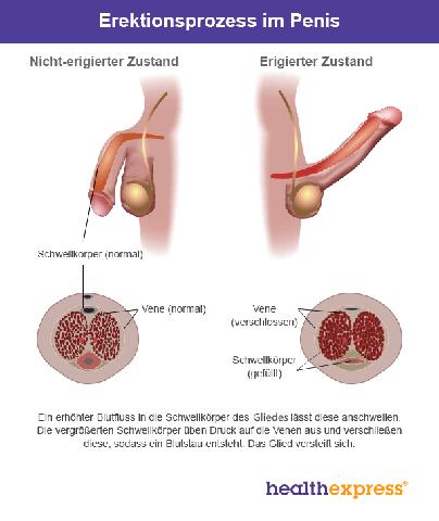Effektive Maßnahmen gegen Erektionsstörungen: Was wirklich hilft Effektive Maßnahmen gegen Erektionsstörungen: Was wirklich hilft