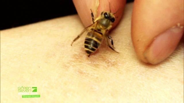 Erste Hilfe bei Bienenstichen: Warum Hitze wirksam ist Erste Hilfe bei Bienenstichen: Warum Hitze wirksam ist