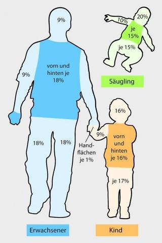 Erste Hilfe bei Verbrühungen: Sofortmaßnahmen und Behandlung
