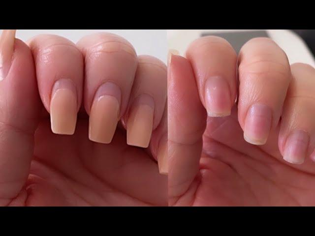 So entfernen Sie aufgeklebte Acrylnägel richtig So entfernen Sie aufgeklebte Acrylnägel richtig