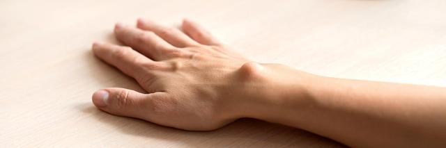 Wie kann man ein Ganglion am Finger selbst behandeln? Wie kann man ein Ganglion am Finger selbst behandeln?