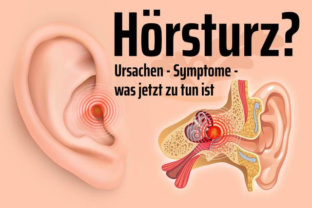 Watte im Ohr: Mögliche Ursachen und kein Anzeichen für einen Hörsturz