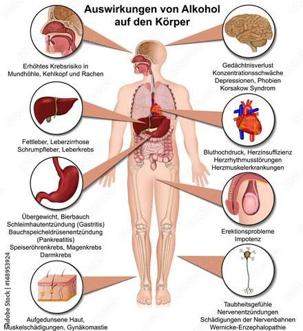 5. Die Auswirkungen von Ethylalkohol auf den menschlichen Körper 5. Die Auswirkungen von Ethylalkohol auf den menschlichen Körper