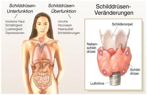 Was ist die Hashimoto-Thyreoiditis? Ursachen, Symptome und Behandlung Was ist die Hashimoto-Thyreoiditis? Ursachen, Symptome und Behandlung