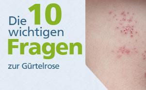 Mehrfache Erkrankung an Gürtelrose: