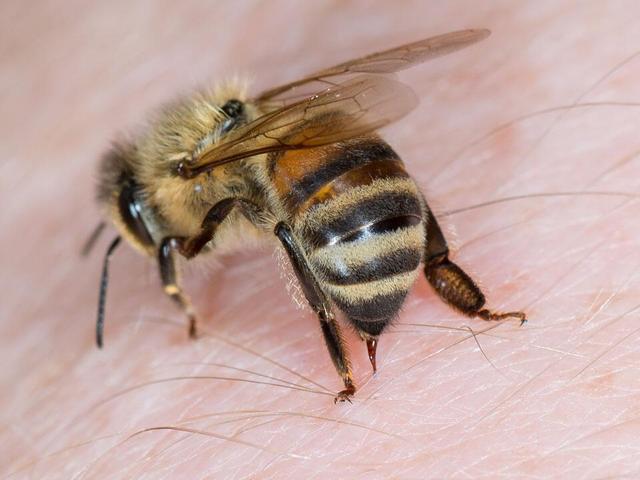 Bienenstich-Symptome erkennen und richtig handeln Bienenstich-Symptome erkennen und richtig handeln