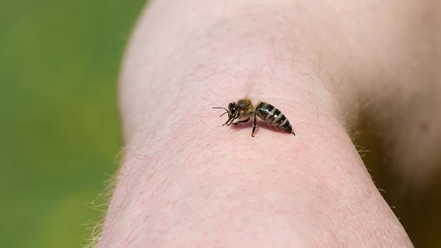 Hausmittel gegen Bienenstiche: Was wirklich hilft Hausmittel gegen Bienenstiche: Was wirklich hilft