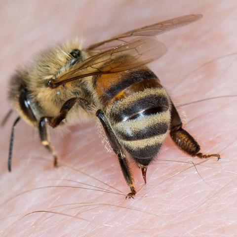 Bienenstich-Allergie: Symptome erkennen und richtig handeln Bienenstich-Allergie: Symptome erkennen und richtig handeln