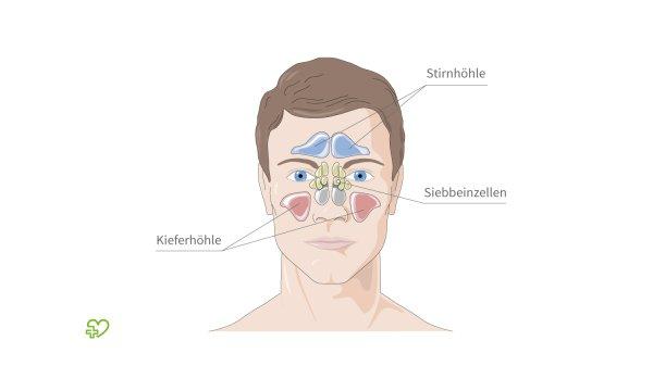 Wann zum Arzt bei einer Stirnhöhlenentzündung? Warnzeichen und Komplikationen Wann zum Arzt bei einer Stirnhöhlenentzündung? Warnzeichen und Komplikationen
