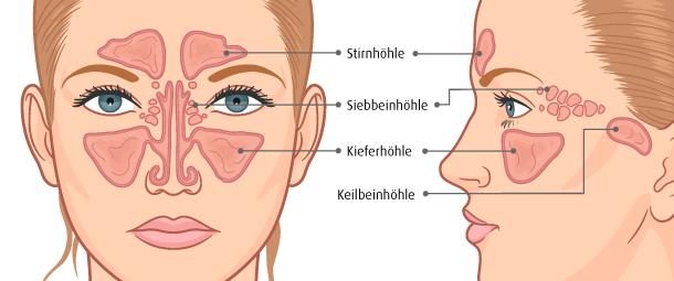 Behandlungsmöglichkeiten bei Stirnhöhlenentzündung: Medikamente und Hausmittel Behandlungsmöglichkeiten bei Stirnhöhlenentzündung: Medikamente und Hausmittel