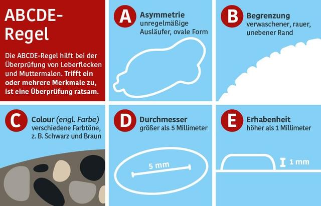 Wann sollte man mit dem Hautkrebsscreening beginnen? Wann sollte man mit dem Hautkrebsscreening beginnen?