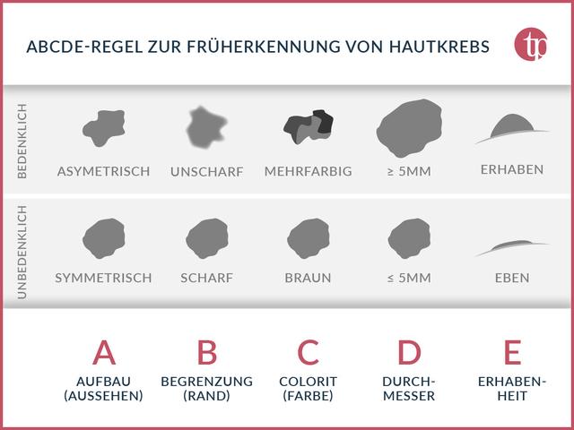 Ab welchem Alter ist eine Hautkrebsvorsorge sinnvoll?