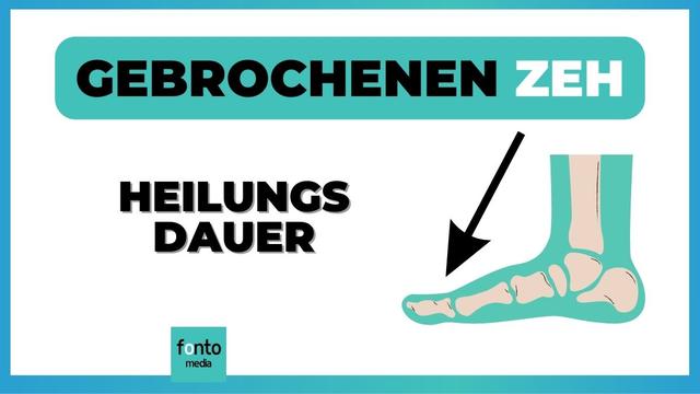 Wieder laufen nach einem Bruch des kleinen Zehs: Dauer der Genesung Wieder laufen nach einem Bruch des kleinen Zehs: Dauer der Genesung
