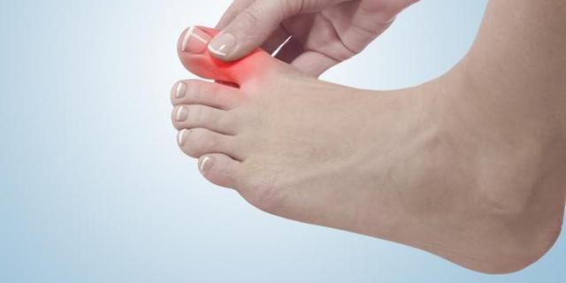 Kleiner Zeh gebrochen: Ab wann ist Laufen wieder möglich? Kleiner Zeh gebrochen: Ab wann ist Laufen wieder möglich?