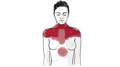 Lebensstiländerungen nach einem Herzinfarkt: Was Frauen beachten sollten