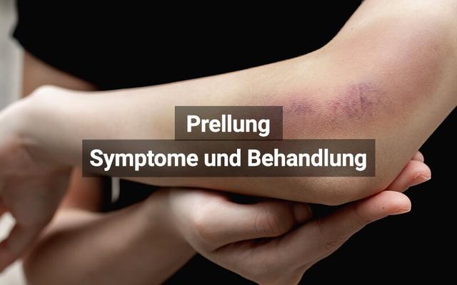 Hilfe bei Prellungen nach Sturz: Symptome richtig deuten und effektive