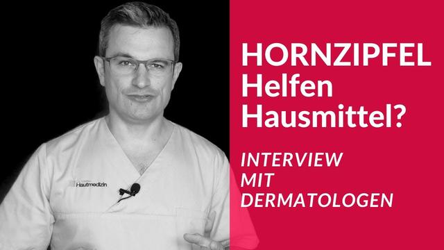 Effektive Methoden zur Entfernung von Hornzipfeln