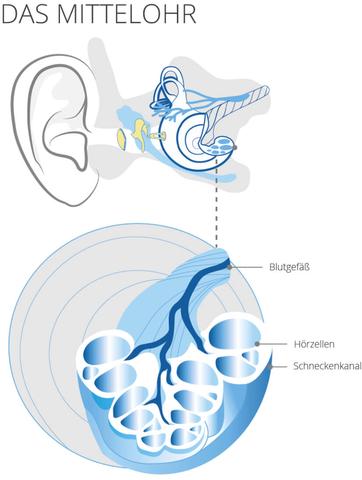 Krankenhausbehandlung beim Hörsturz: Wann ist sie notwendig?