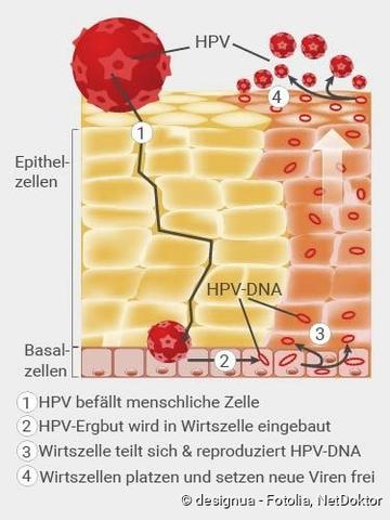 HPV-Infektion: Wie lange kann man andere anstecken? HPV-Infektion: Wie lange kann man andere anstecken?