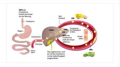 Hypercholesterinämie: Ursachen, Symptome und Behandlung Hypercholesterinämie: Ursachen, Symptome und Behandlung