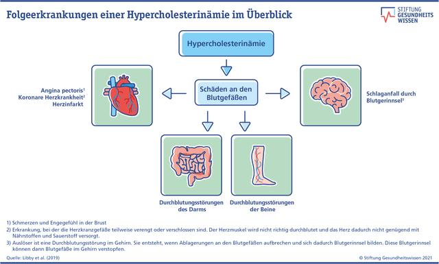 Hypercholesterinämie: Definition, Symptome und Risiken Hypercholesterinämie: Definition, Symptome und Risiken