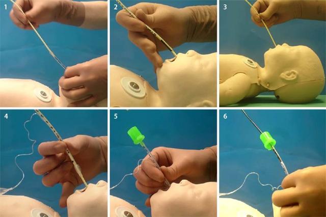 6. Alternative Methoden zur Intubation: Larynxmaske und fiberoptische Intubation