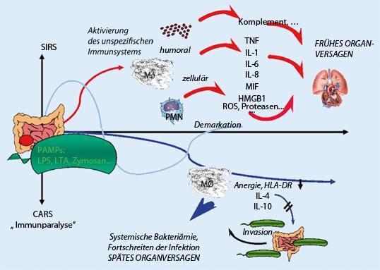 Überlebenszeit bei schwerer Sepsis: Was ist zu erwarten? Überlebenszeit bei schwerer Sepsis: Was ist zu erwarten?