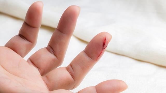 Die Heilungszeit nach einer schweren Sepsis: Was kann man erwarten? Die Heilungszeit nach einer schweren Sepsis: Was kann man erwarten?