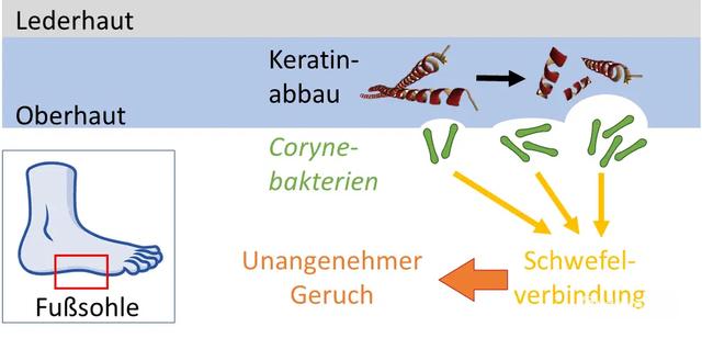 Hausmittel gegen Keratoma sulcatum: Selbstbehandlungsmöglichkeiten