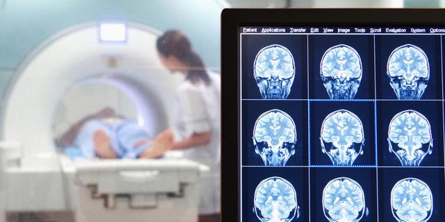 Die Kernspintomographie: Eine schonende Methode zur Diagnose von Krankheiten Die Kernspintomographie: Eine schonende Methode zur Diagnose von Krankheiten