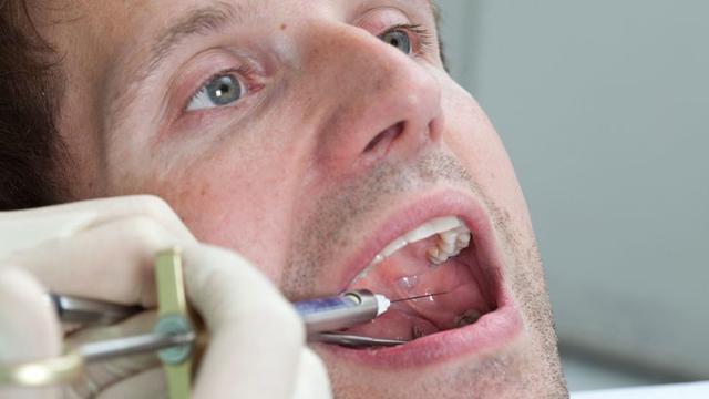 Tipps zur Behandlung von anhaltender Betäubung nach dem Zahnarztbesuch Tipps zur Behandlung von anhaltender Betäubung nach dem Zahnarztbesuch