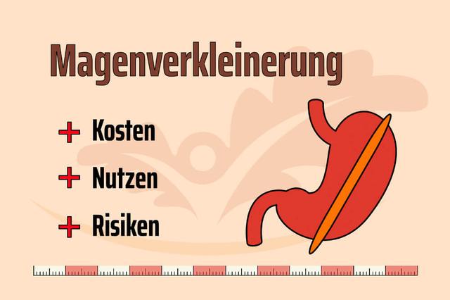 Kosten einer Magenverkleinerung: Was Sie wissen sollten Kosten einer Magenverkleinerung: Was Sie wissen sollten